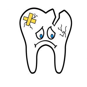 An illustration of a chipped tooth