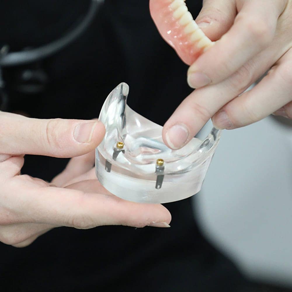 dental implants treatment sheffield